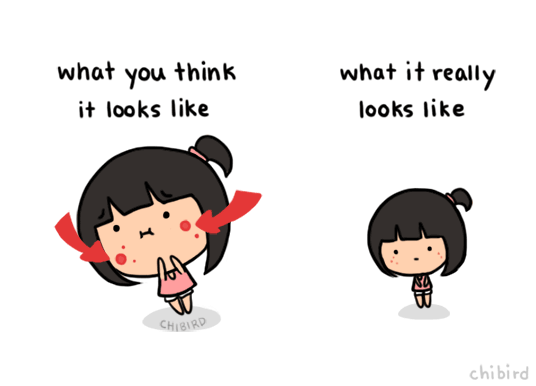 chibird:  It’s never as bad as when you’re staring at your acne 5 inches away from the mirror!